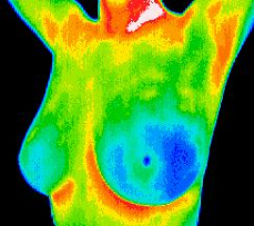 thermograpya