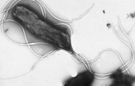 הליקובקטר פילורי